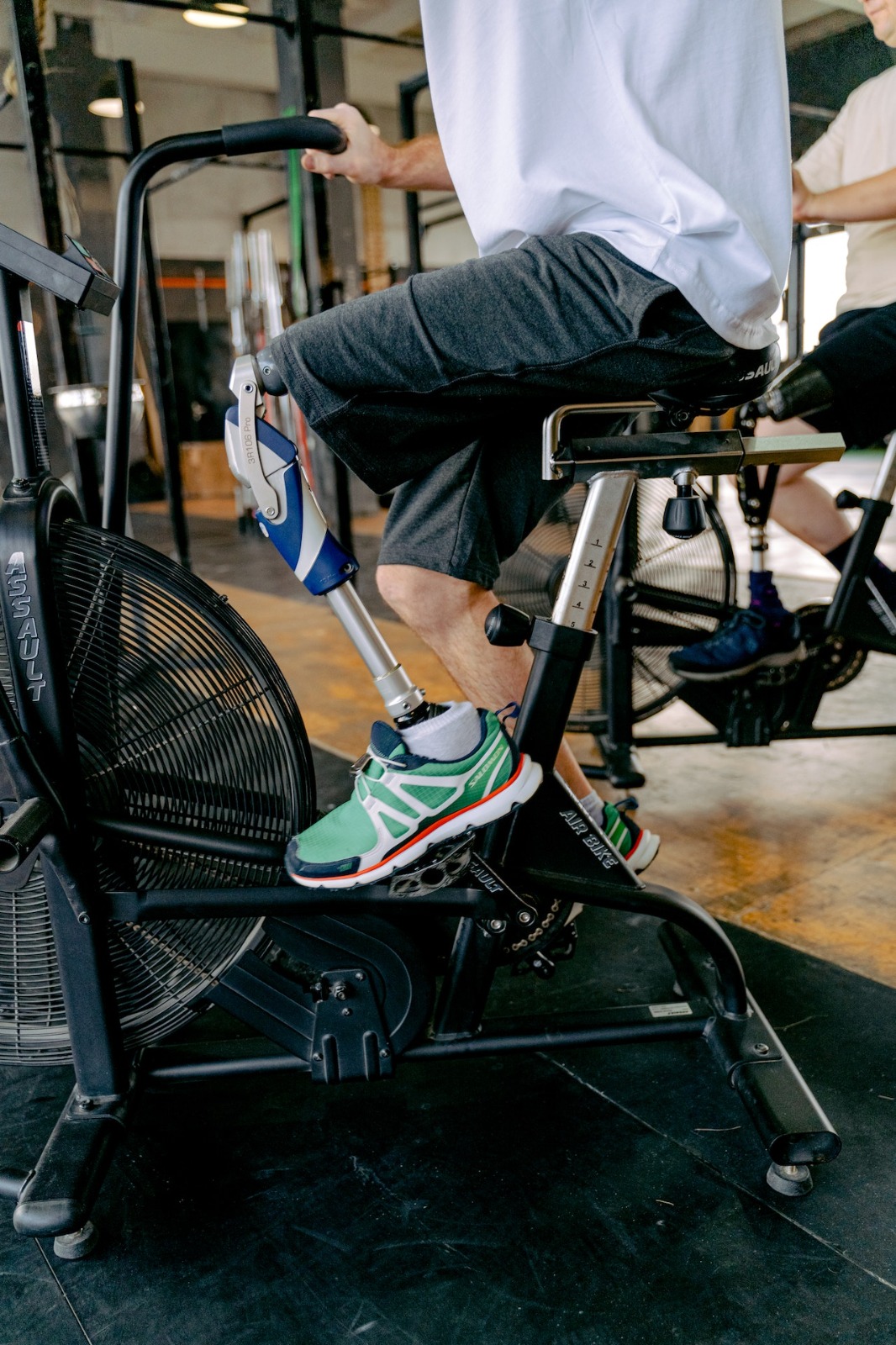 Can I Use A Stationary Bike After Knee Replacement